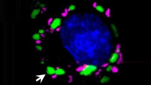 Drugs in Development for Cancer May Also Fight Brain Diseases