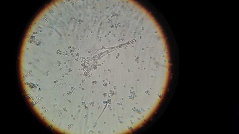 Combination Therapy in the Face of Growing Antibiotic Resistance