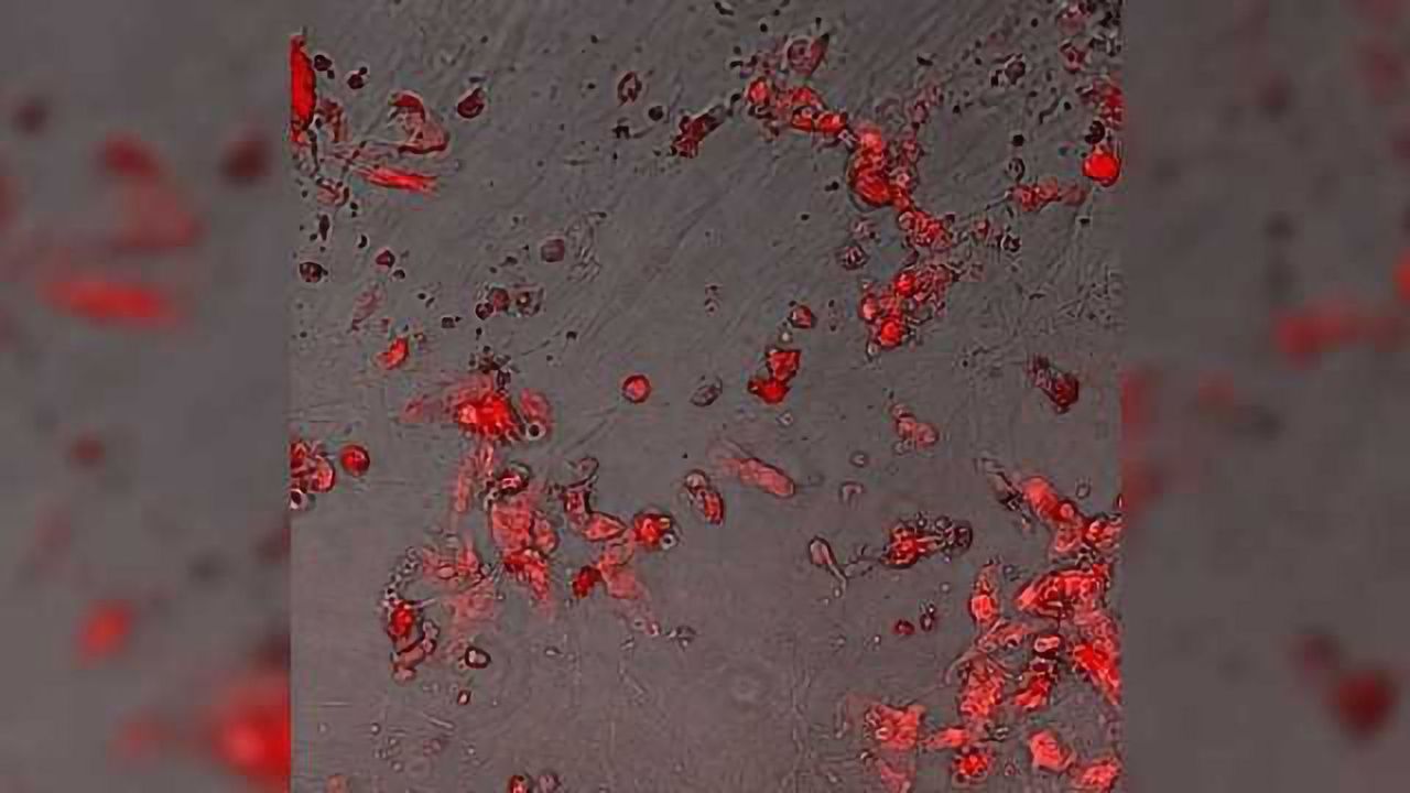Restoring Protective Mechanisms in the Aging Kidney
