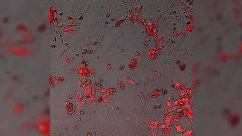 Restoring Protective Mechanisms in the Aging Kidney