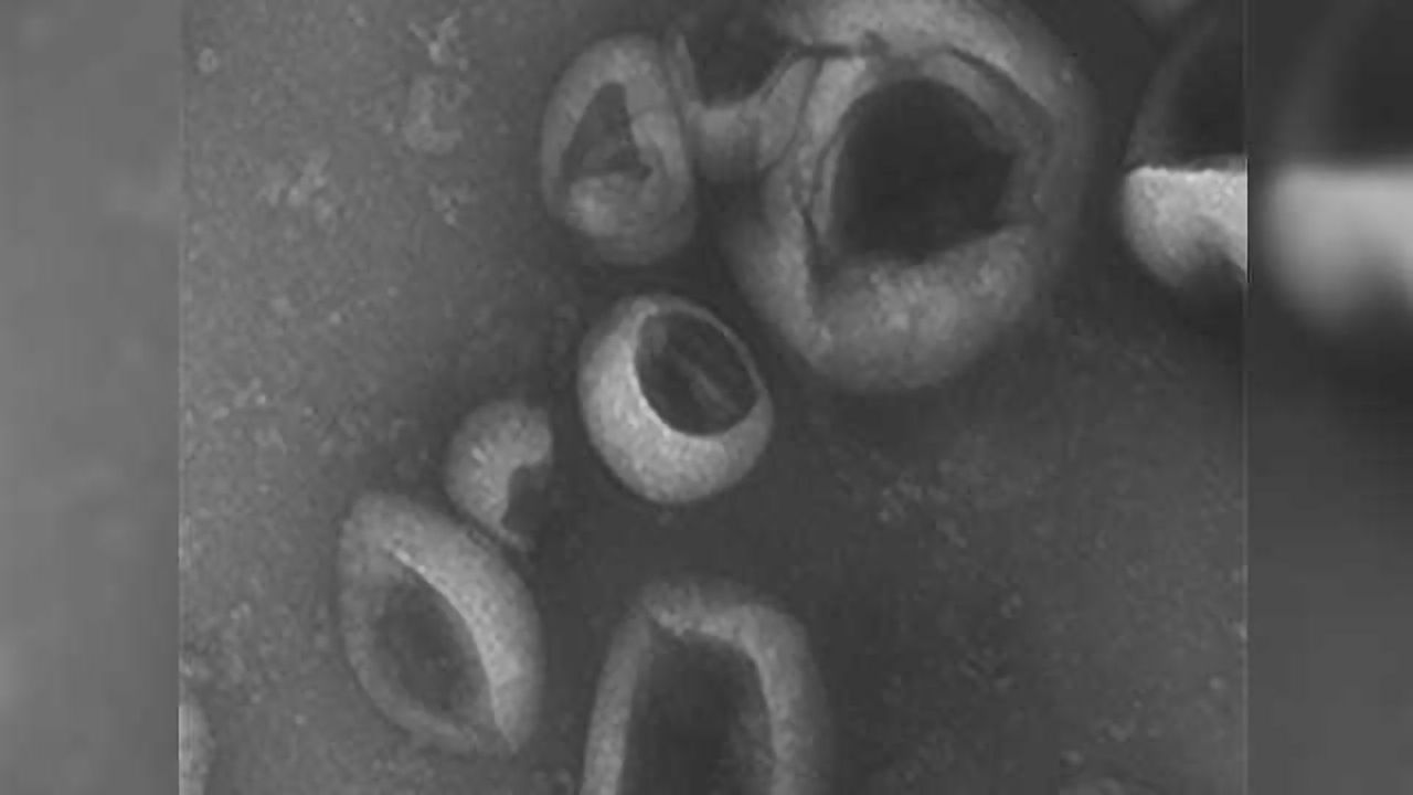 Key Role for Extracellular Vesicles in Fibrosis Development Established