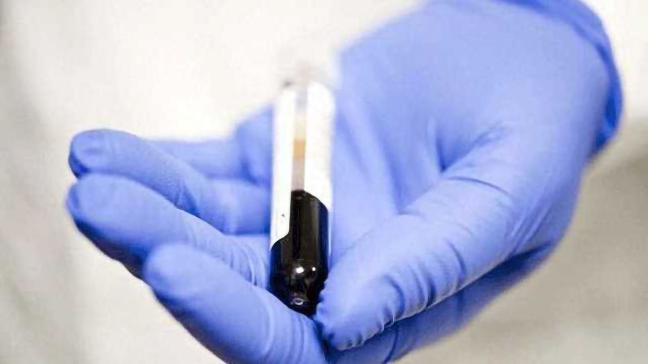 Blood Test Could Detect Kidney Cancer up to 5 Years Earlier