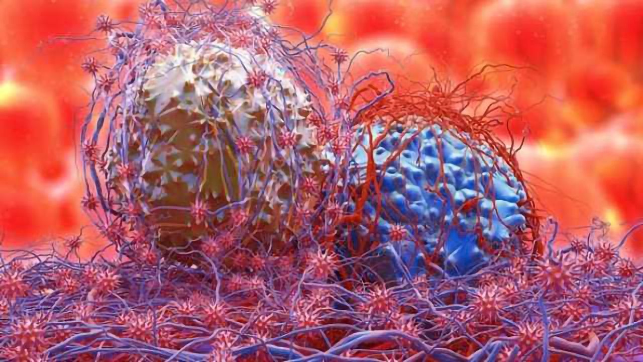 Research Identifies Potential Guidance for Gastric Cancer Treatment