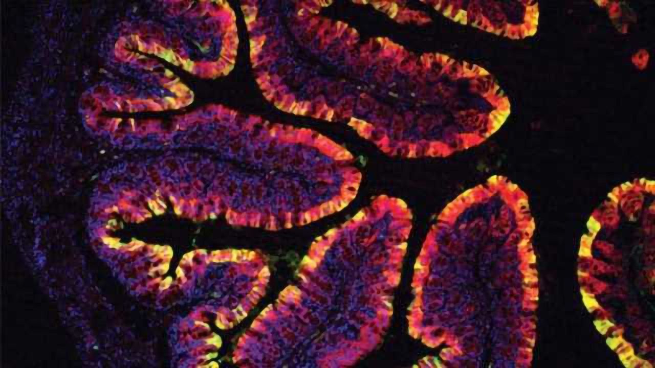 Chemicals Found in Vegetables Prevent Colon Cancer in Mice