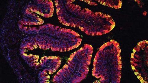 Chemicals Found in Vegetables Prevent Colon Cancer in Mice