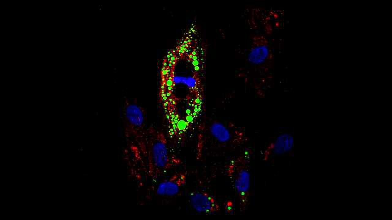 Uncoupling Obesity from Diabetes