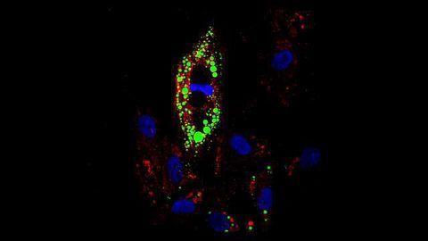 Uncoupling Obesity from Diabetes