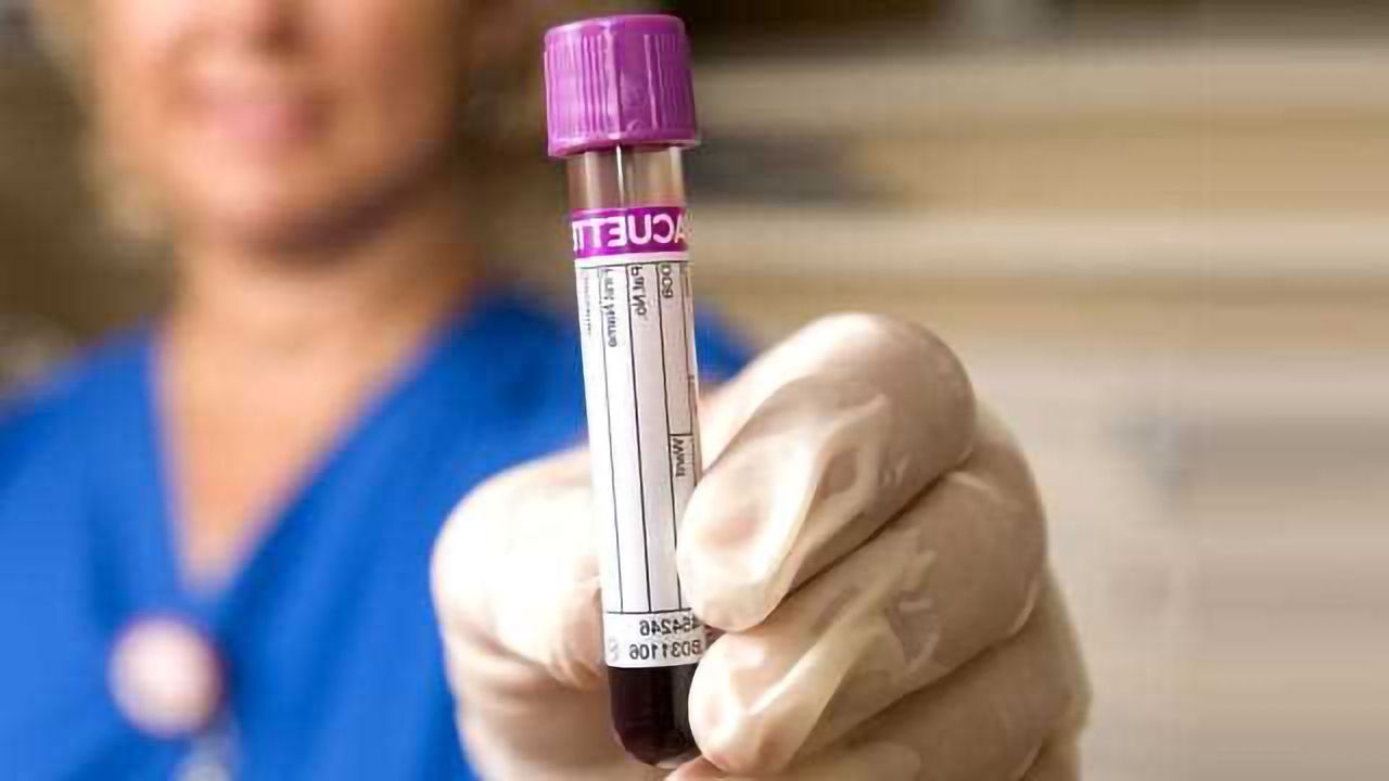 Blood Test Could Detect Kidney Cancer Up to Five Years Earlier