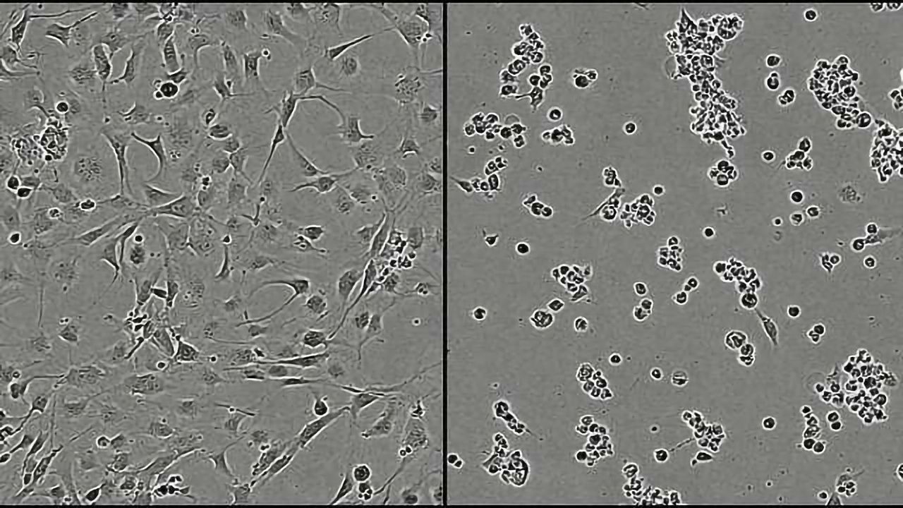 Making Malignant Brain Tumors Self-Destruct