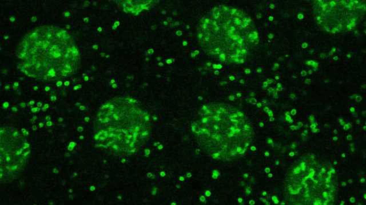 Lipid Droplets: More Than Just Fat Stores