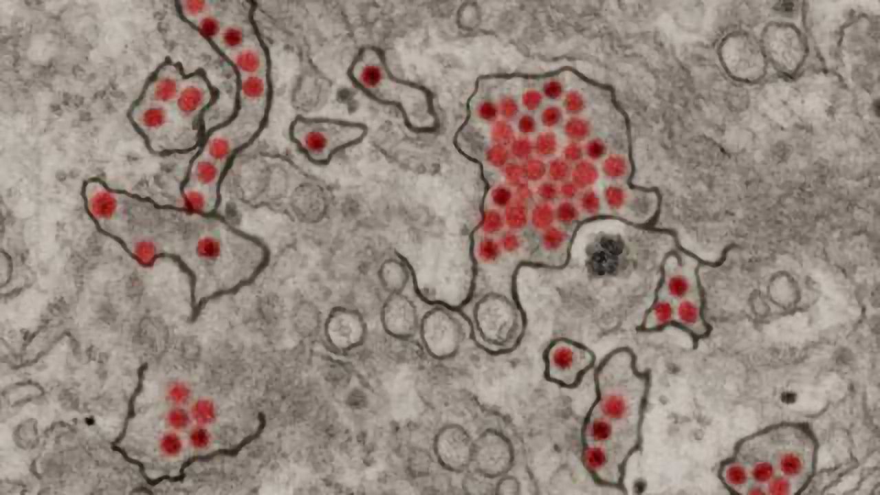 Zika Vaccine Clinical Trial Begins