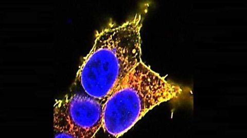 Miscarriage Cause and Key Cellular Targets of Potential Drugs Uncovered