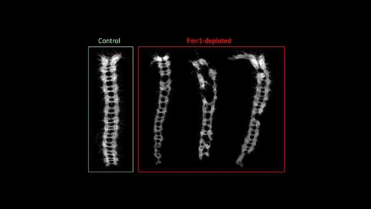 Autism Linked to Egg Cells' Difficulty Creating Large Proteins