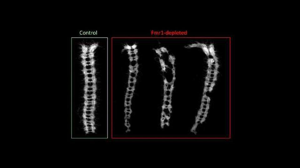 Autism Linked to Egg Cells' Difficulty Creating Large Proteins content piece image
