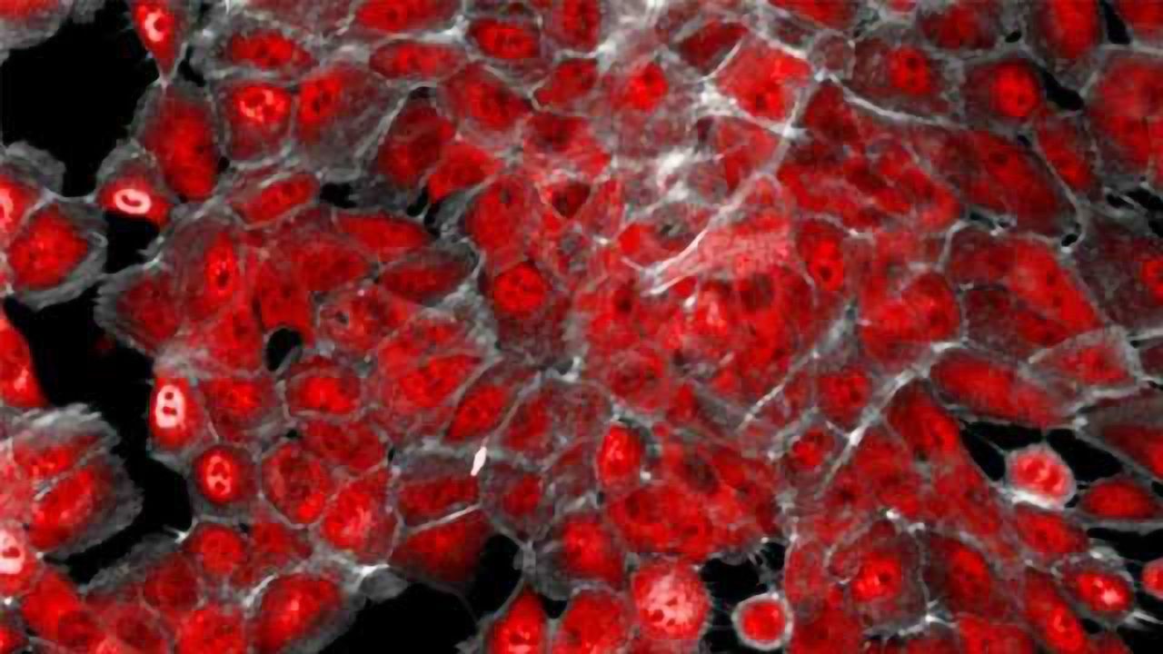 Breast Cancer Vulnerability Could Be Exploited by Future Targeted Drugs