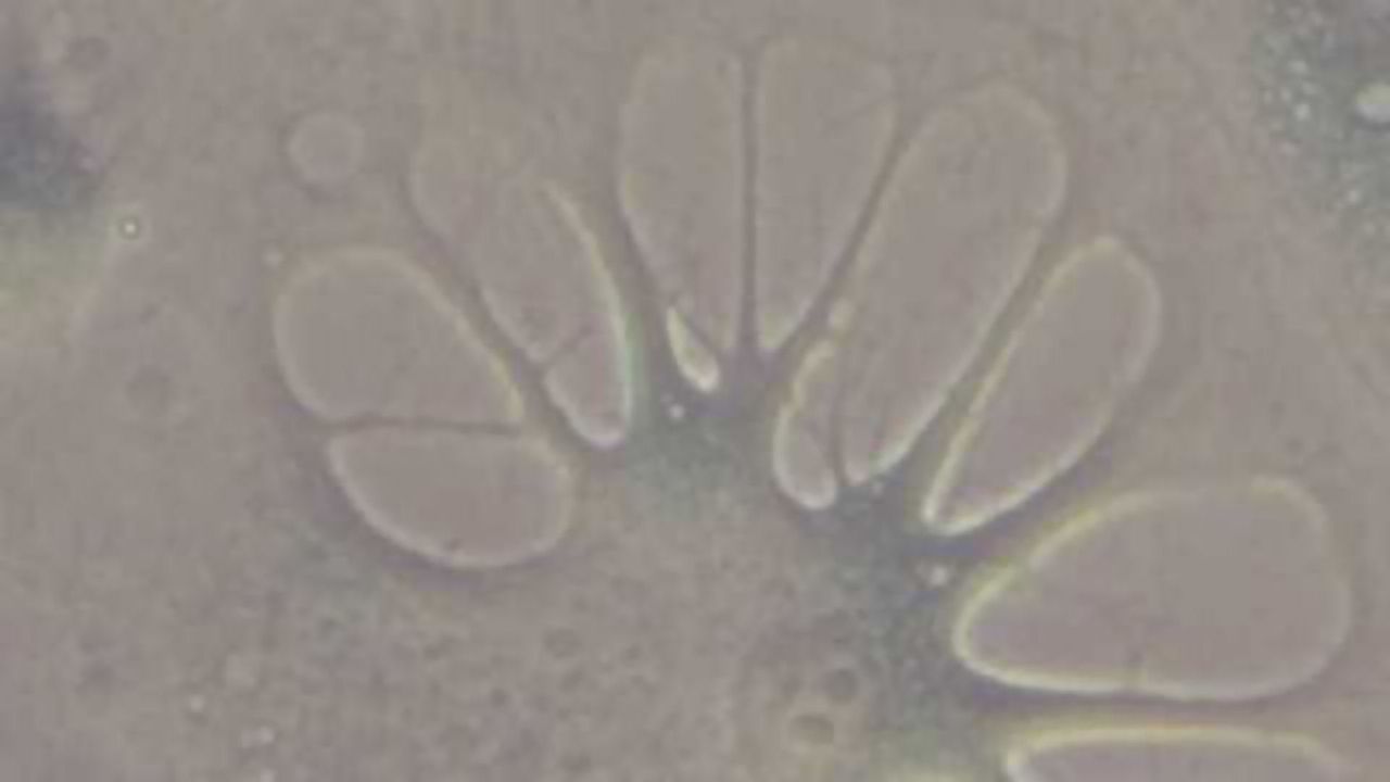 Ageing in Human Cells Successfully Reversed in the Lab