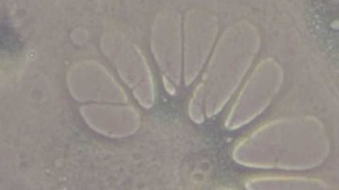Ageing in Human Cells Successfully Reversed in the Lab
