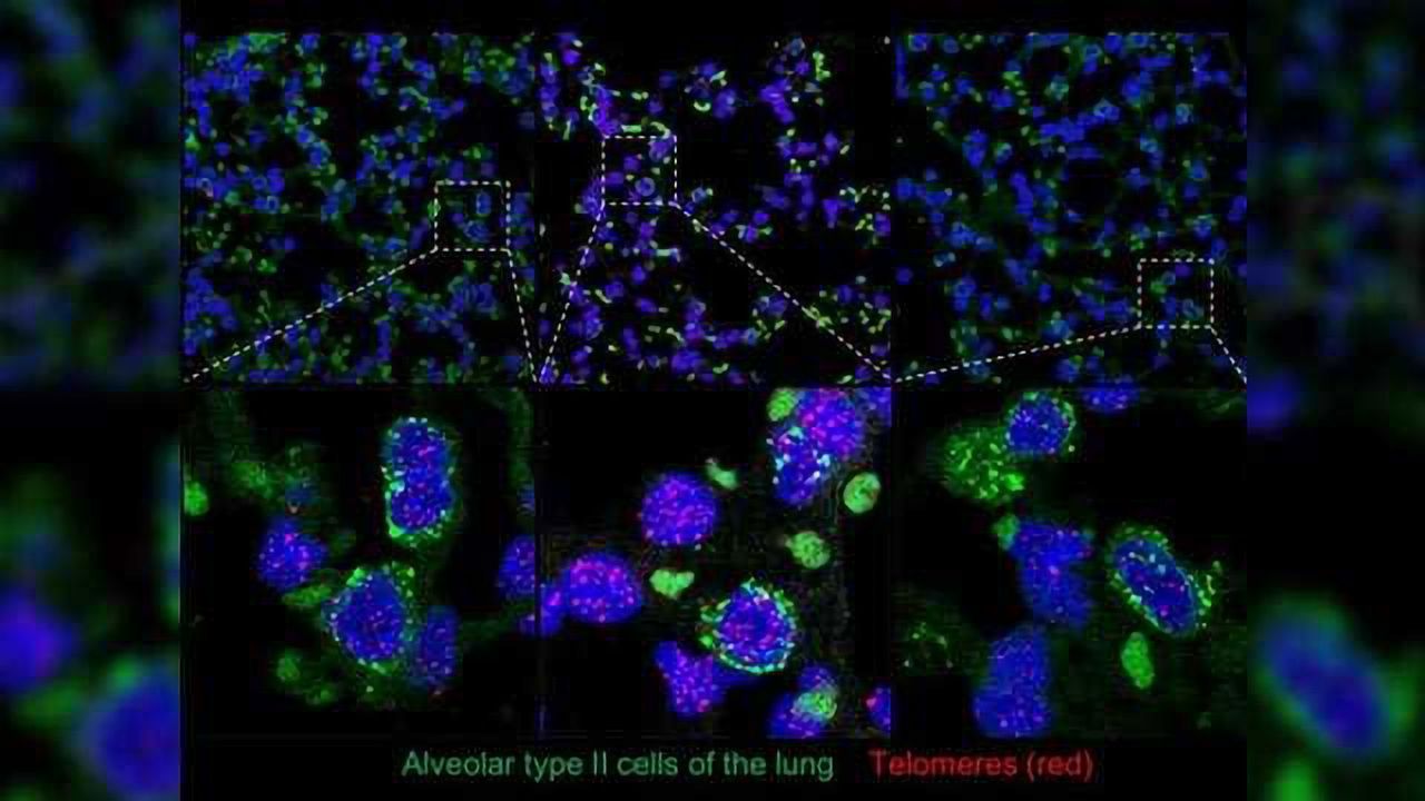 Mouse Model Shows Gene Therapy Vectors Carrying Telomerase Gene Do Not Increase Cancer Risk