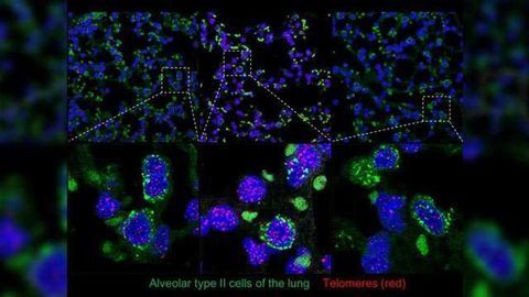 Mouse Model Shows Gene Therapy Vectors Carrying Telomerase Gene Do Not Increase Cancer Risk