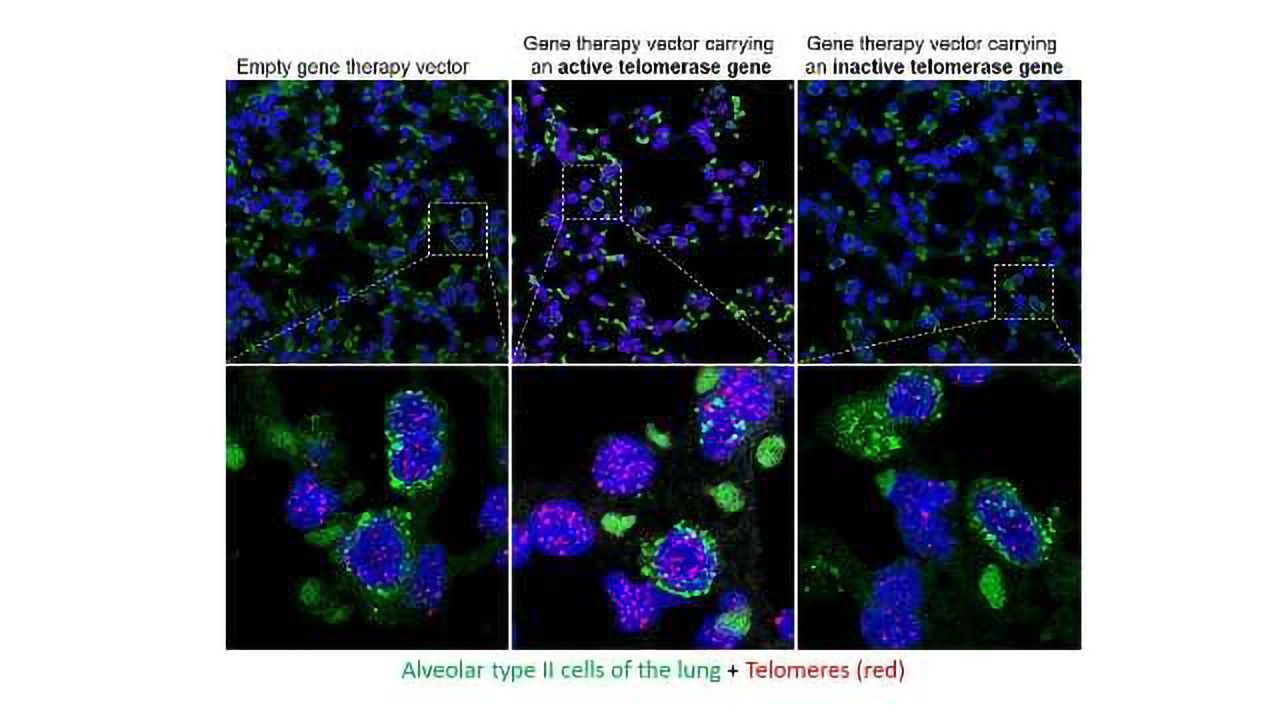 No Cancer Risk for Telomerase Gene Therapy