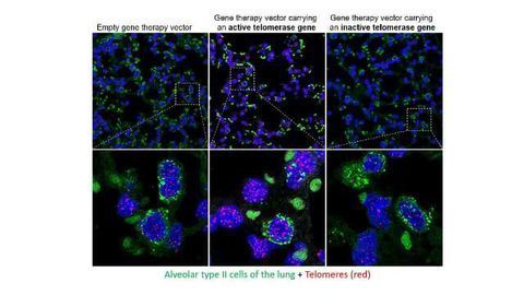No Cancer Risk for Telomerase Gene Therapy