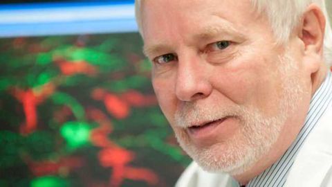 New Subtype of MS: Neuronal loss but no white matter demyelination