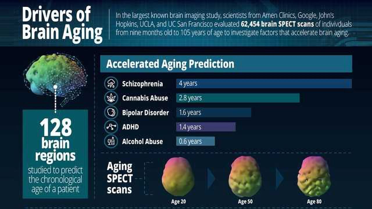 Largest Brain Study of 62,454 Scans Identifies Drivers of Brain Aging