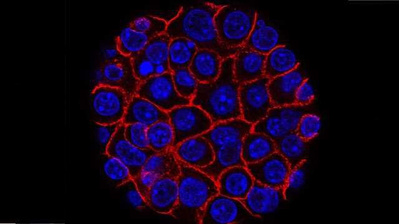 Compound Advances into Phase 1 Trial for Pancreatic Cancer