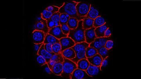 Compound Advances into Phase 1 Trial for Pancreatic Cancer