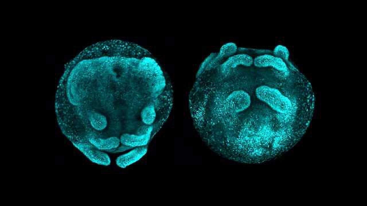 Spiders and Insects Share Ancestral Segmentation Gene