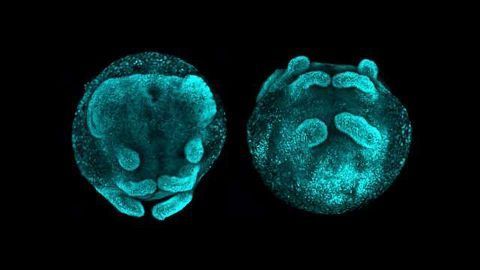 Spiders and Insects Share Ancestral Segmentation Gene