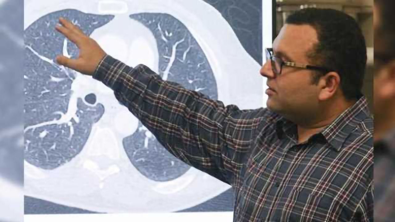 A.I. System Developed to Detect Often-Missed Cancer Tumors