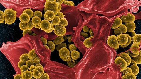 Cleverly Located Proteins Make Some Bacteria Especially Dangerous