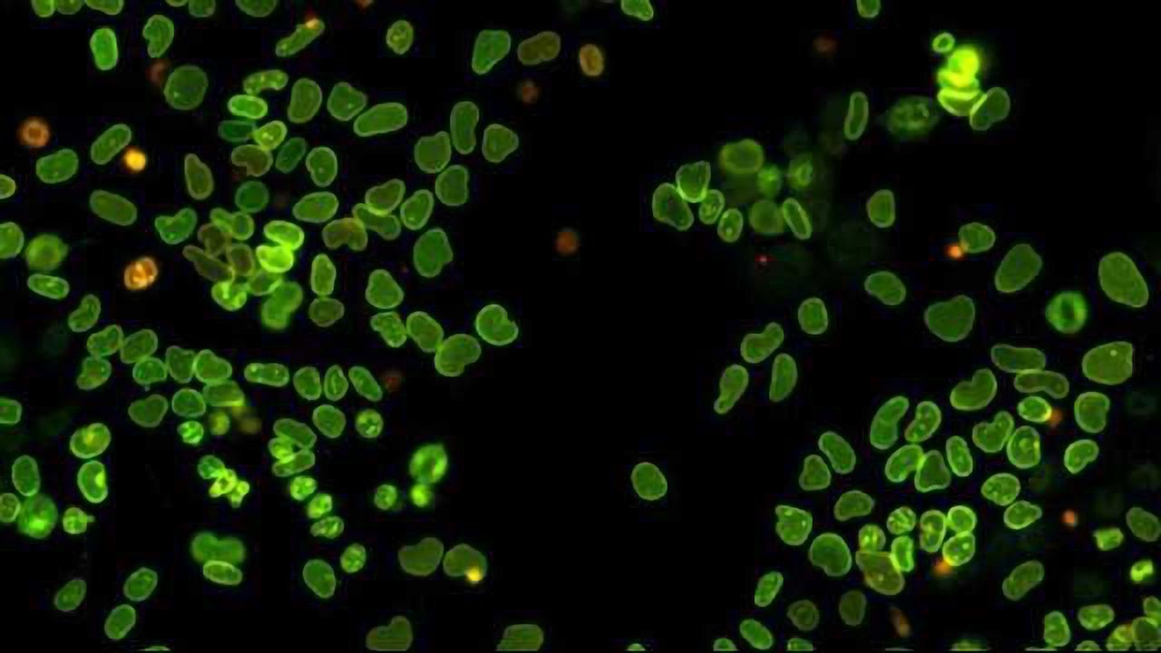 The Birth and Death of Proteins in a Single Cell