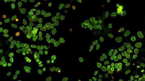 The Birth and Death of Proteins in a Single Cell