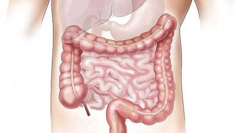 Cellular Pumps Protect the Gut from Toxic Effects of Compounds