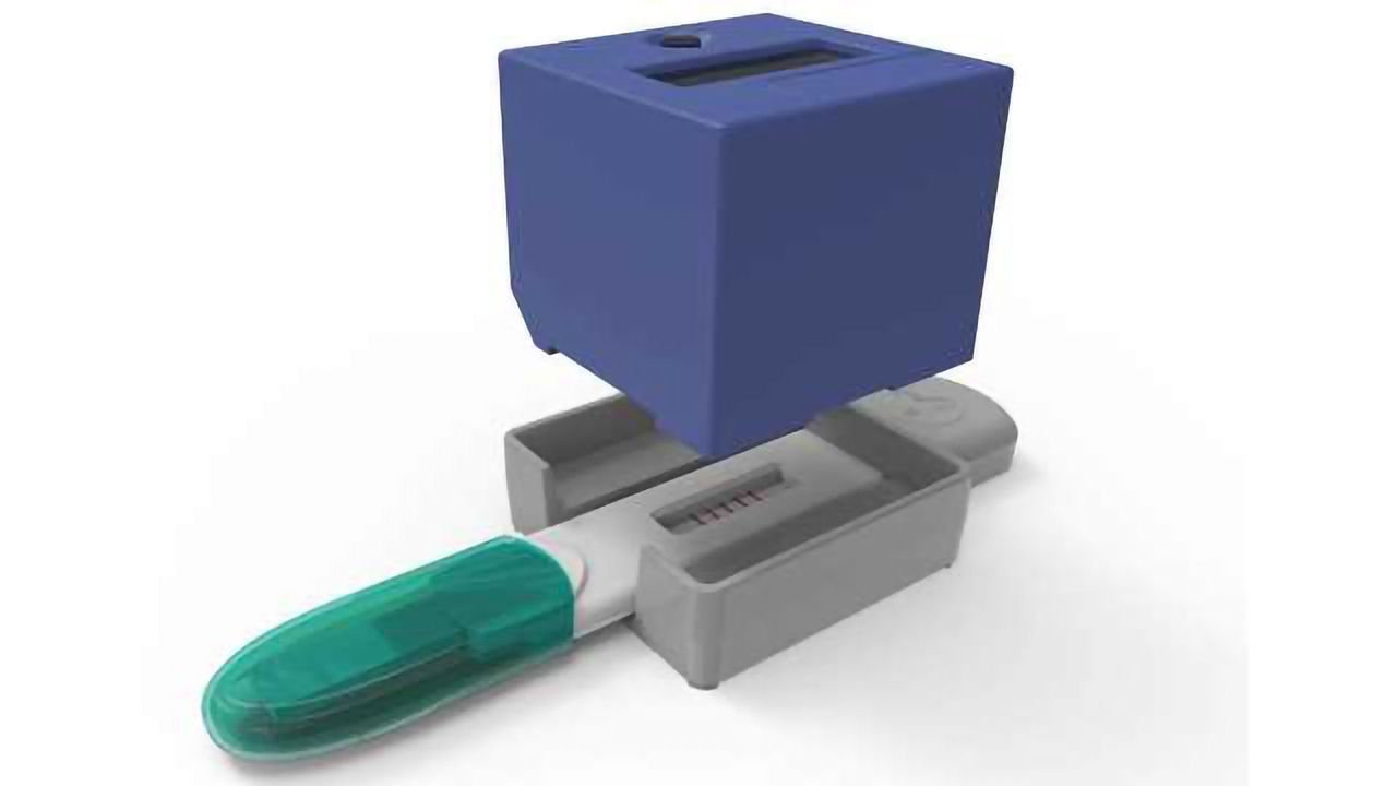 Monitoring Pulmonary Exacerbation in Cystic Fibrosis: The Hunt for Urine-based Biomarkers Begins