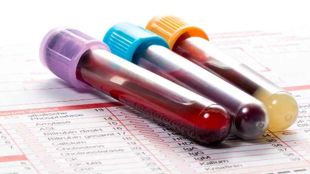 Cancer Biomarkers: the Liquid Biopsy Revolution