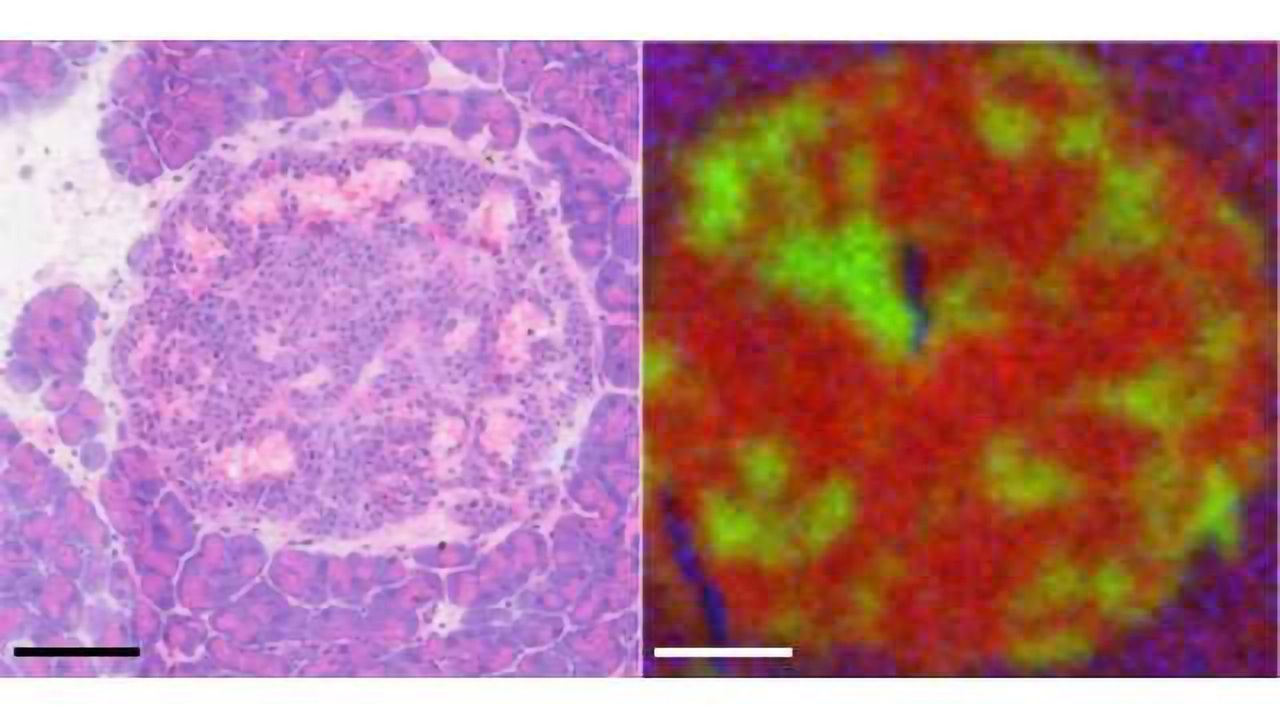 Mapping Out Cancer's Movements