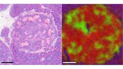 Mapping Out Cancer's Movements