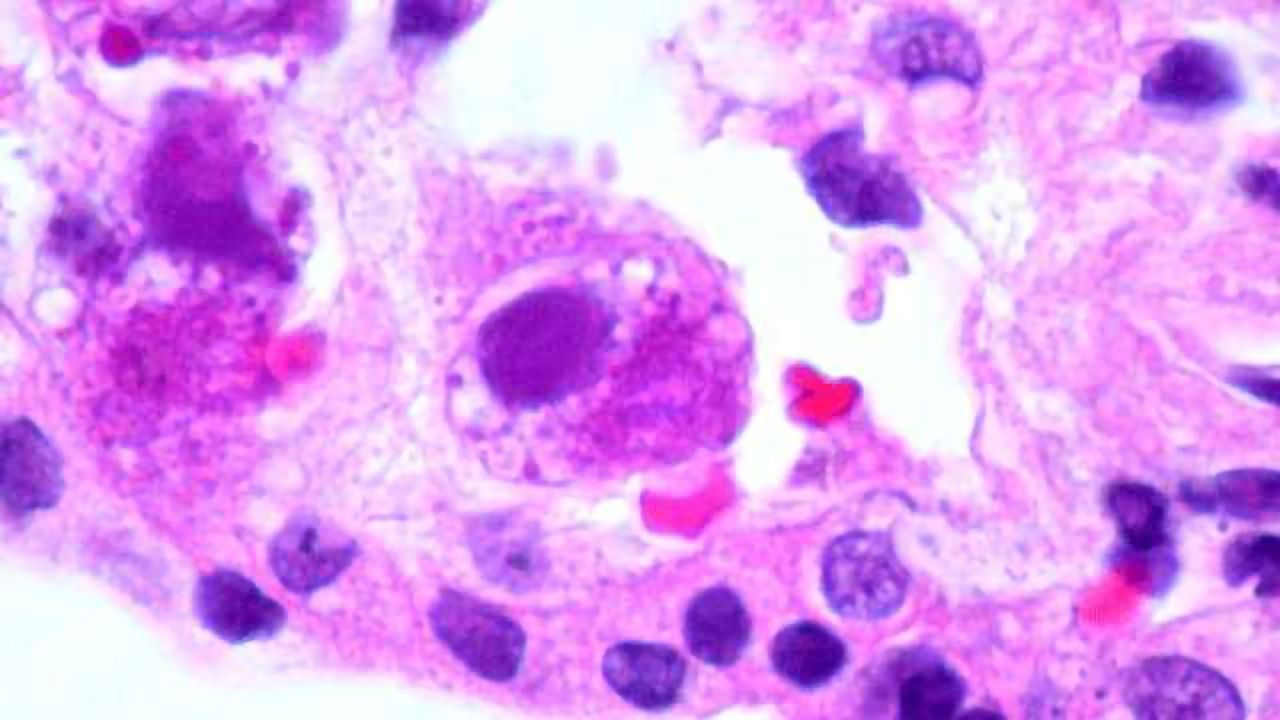 New Antiviral Targets Uncovered in Herpesvirus Study