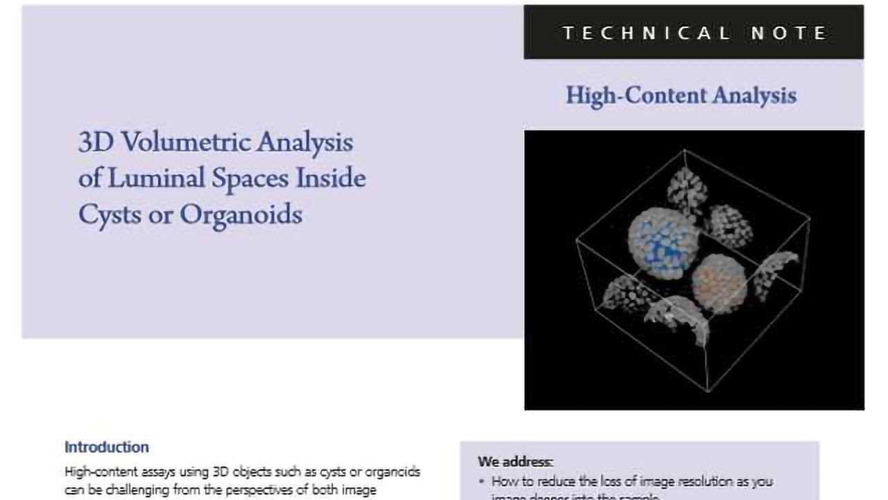 3D High-Content Analysis of Luminal Spaces Inside Cysts or Organoids