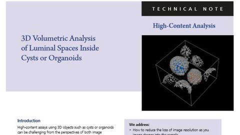 3D High-Content Analysis of Luminal Spaces Inside Cysts or Organoids