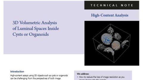 囊肿或器官内部的腔空间的3D高含量分析