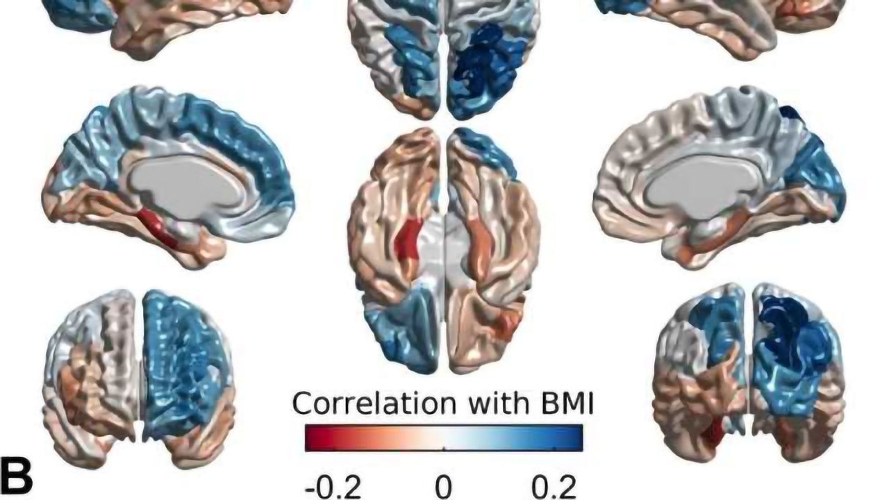 The Link Between Obesity, the Brain, and Genetics
