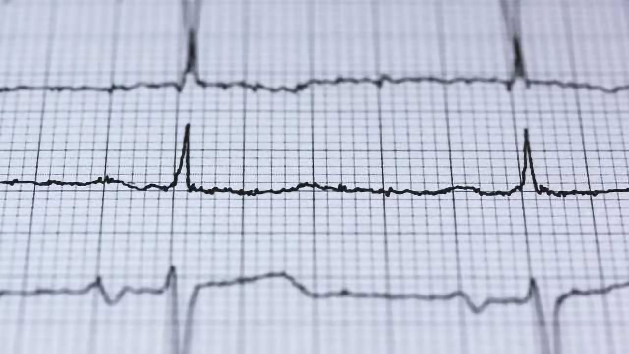 first-randomised-trial-tests-criteria-used-to-diagnose-heart-attack