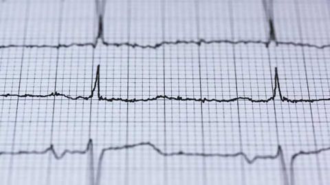 First Randomised Trial Tests Criteria Used to Diagnose Heart Attack