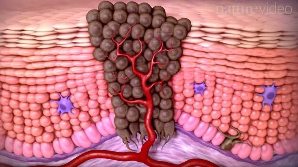 Tumor Immunology and Immunotherapy content piece image
