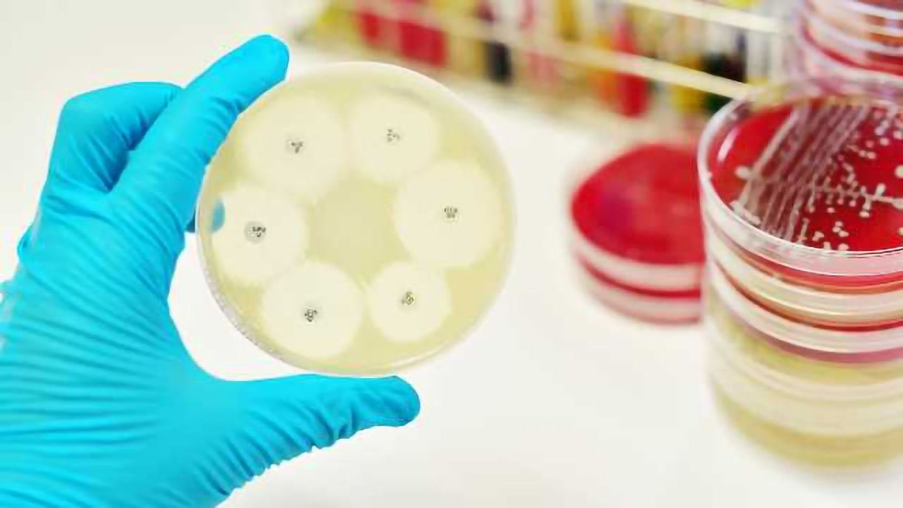 Antimicrobial Resistance – the Rise of Global Superbugs