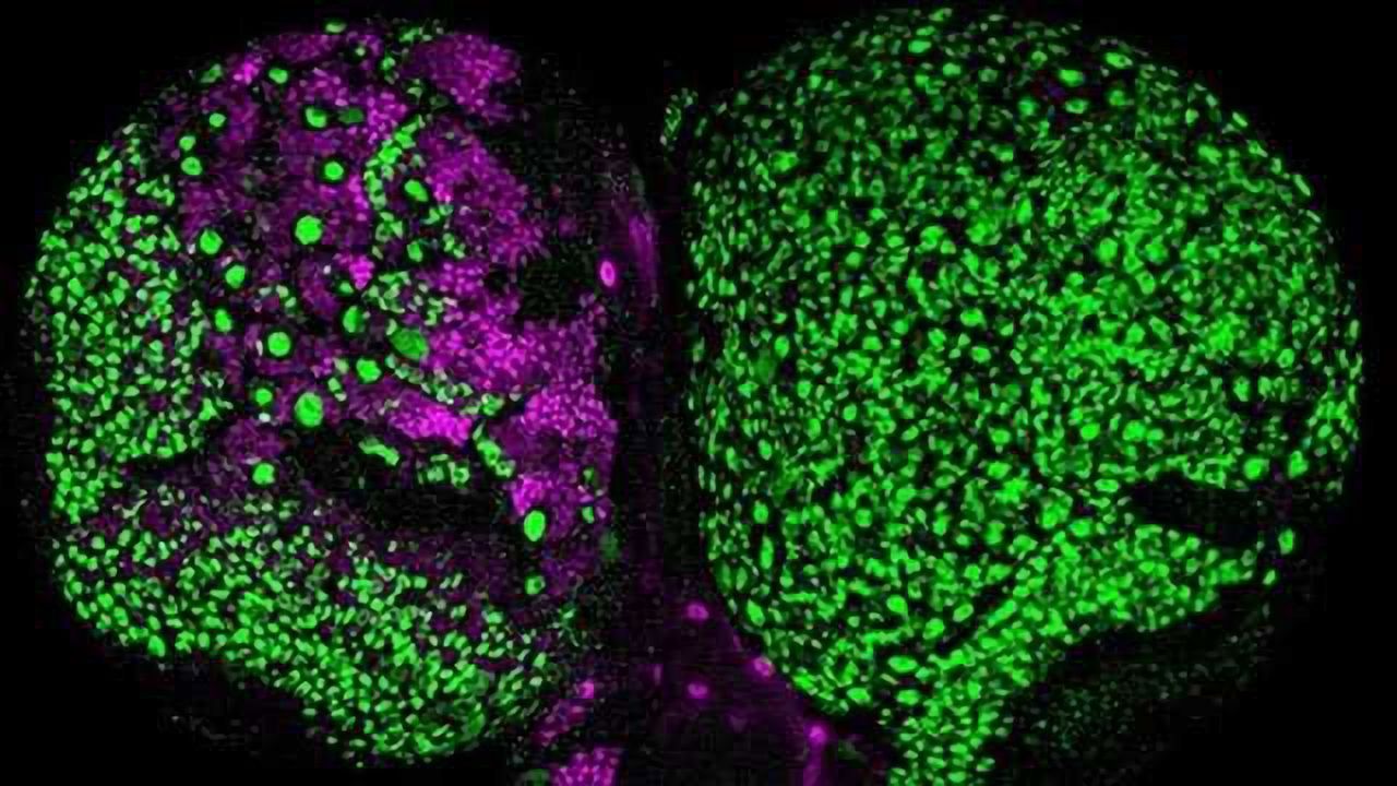 The Body’s ‘Bomb Squad’ Can Help Protect Against Brain Tumors